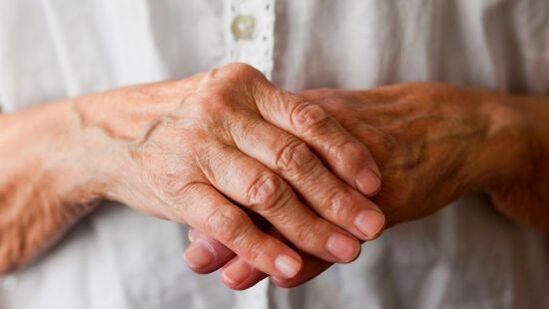 Artriti reumatoid shkakton dhimbje dhe ënjtje në nyjet e gishtërinjve. 