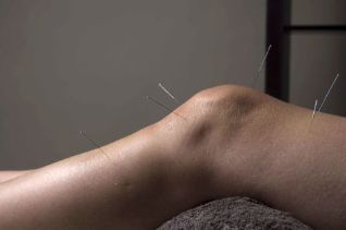 Akupunktura promovon riparimin e indeve të përbashkët